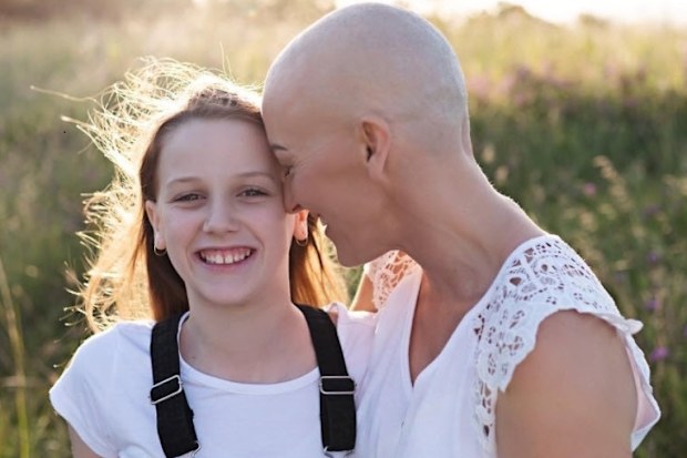Kat daughter alopecia