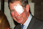 397576 01: Prince Charles arrives at the entertainment artists benevolent fund home November 20, 2001 in Twickenham, London. The prince wore a dressing over his left eye after sustaining an injury while cutting wood in his garden on November 19th. (Photo by James Whatling/UK Press/Getty Images)