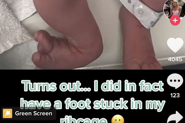 Bethany Love shares photo of baby's misshapen feet that were stuck under her rib cage 