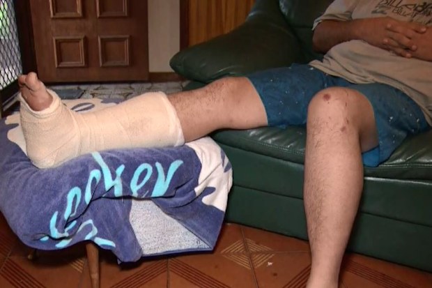 The security vision technician says he was hit from behind.