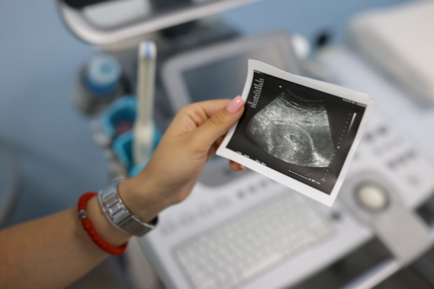 Ultrasound