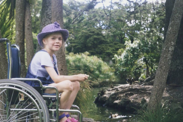 Model as child amputee