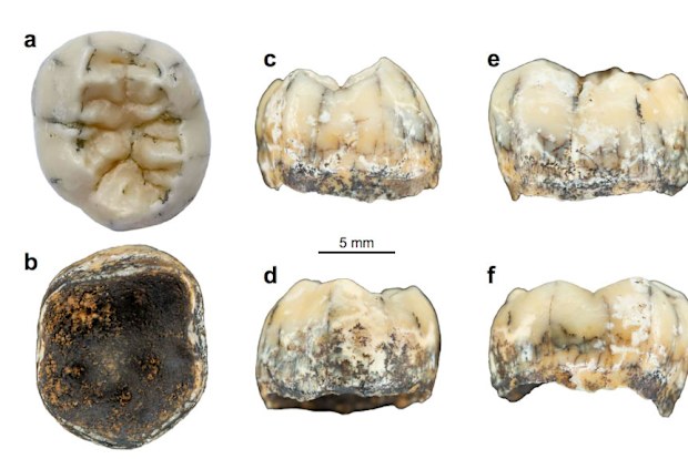 The tooth shown from top, bottom and side angles.