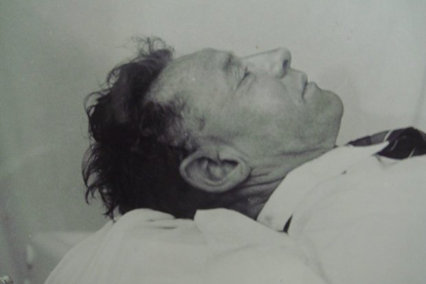 The Somerton Man shortly after autopsy