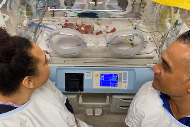 Aurelia was born prematurely and spent over two months in the NICU