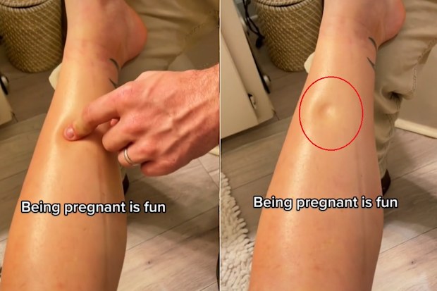 Pregnant woman on TikTok shows bizarre pregnancy symptom. 