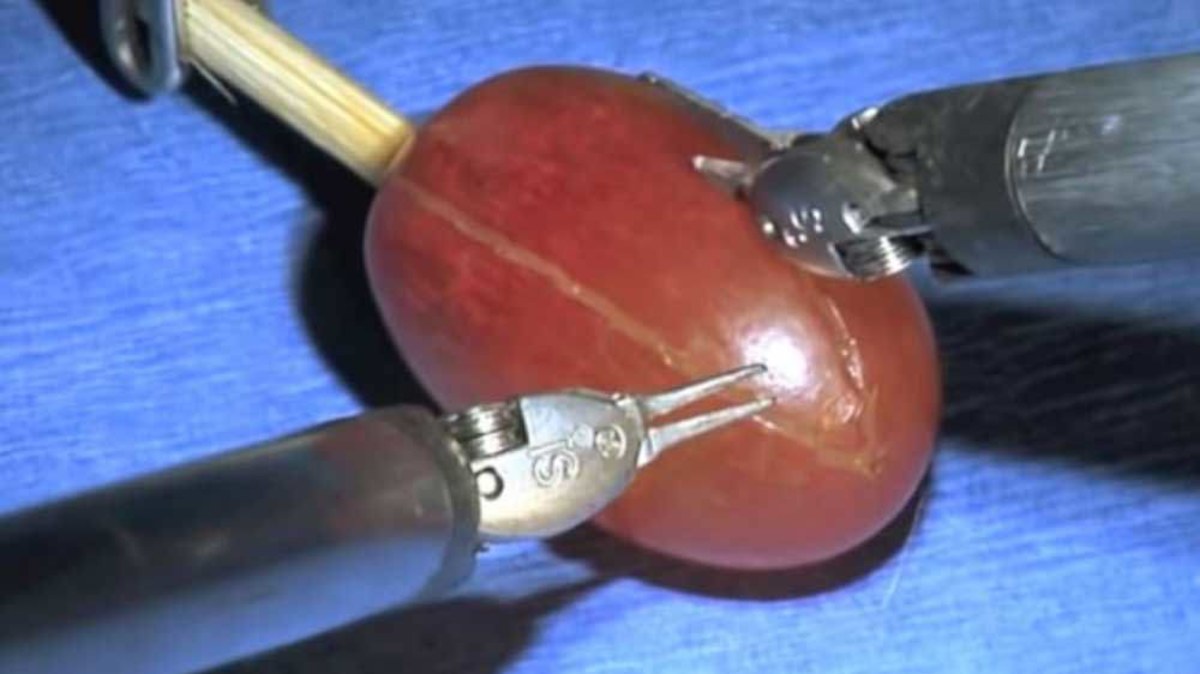 Grape surgery meme goes viral on Twitter | Nine.com.au