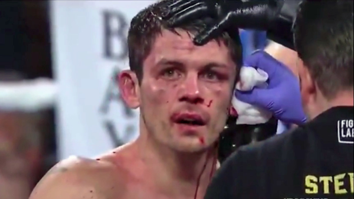 Boxing: Stephen Smith suffers horrific ear injury in bout against ...