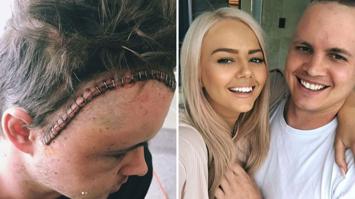Johnny Ruffo recovering well after brain cancer diagnosis | Nine.com.au