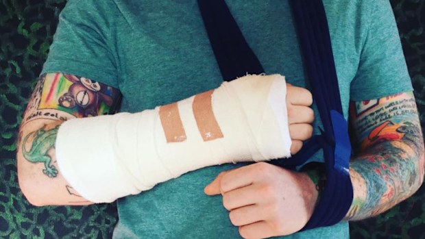 Ed Sheeran was reportedly hit by a car while riding his bike in London. (Ed Sheeran/Instagram)