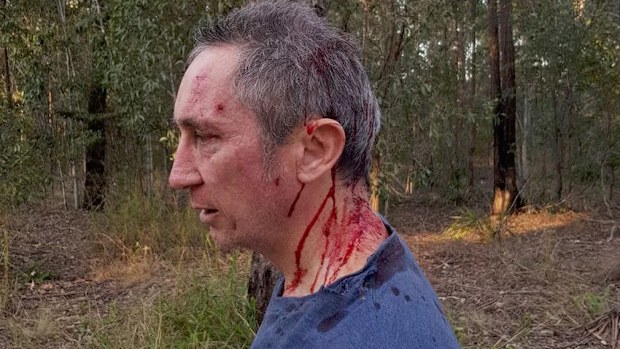 Jim Dodrill says he was attacked by a group of men in Ipswich bushland. (Source: Guardian)