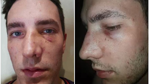 Joel Donnelly copped a punch to the face in a road rage attack. (Supplied)