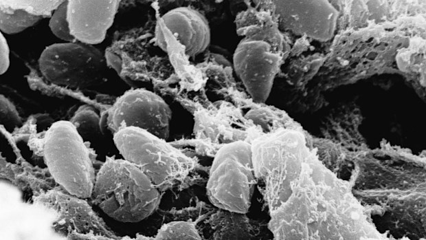 An electron micrograph depicting a mass of Yersinia pestis bacteria, the cause of bubonic plague. (AP Photo/Rocky Mountain Laboratories)