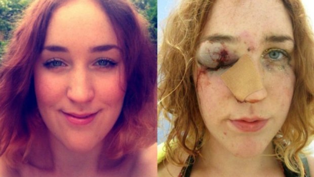 Mary Brandon shared a before and after photo of her horrific assault on Facebook. (Supplied)