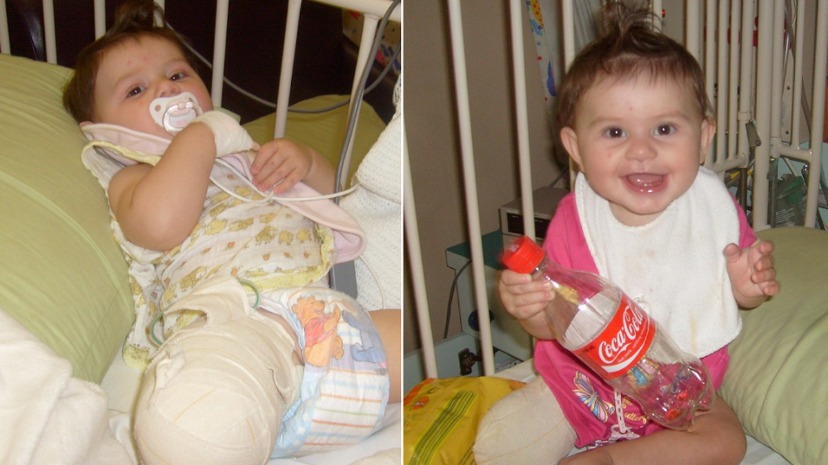 Newcastle mum's heartbreaking choice to amputate her baby's leg | Nine ...