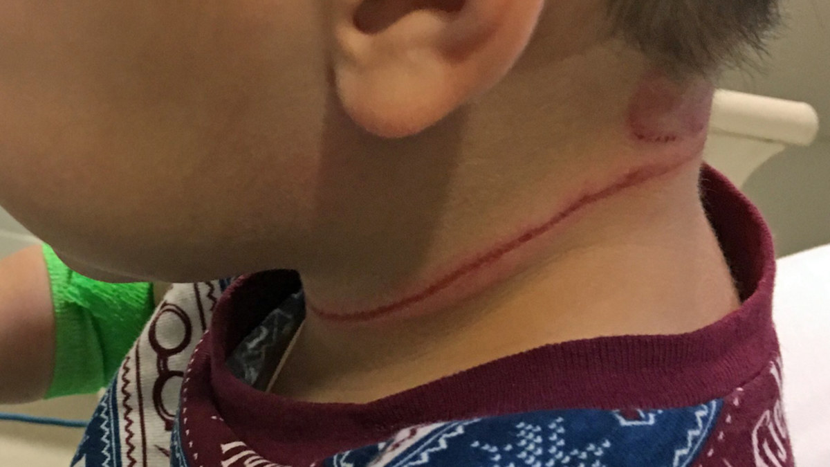 Toddler almost strangled by blind cord, mum's warning | Nine.com.au