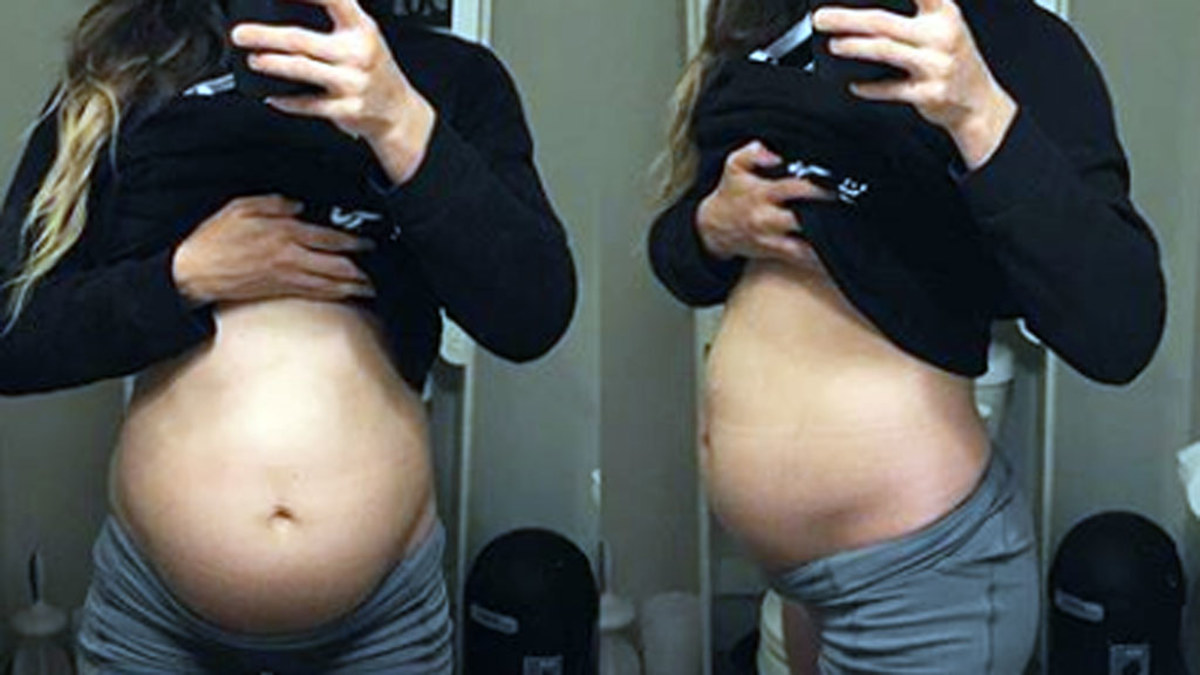 Photos of extreme bloating after eating stuns bodybuilder's fans | Nine ...