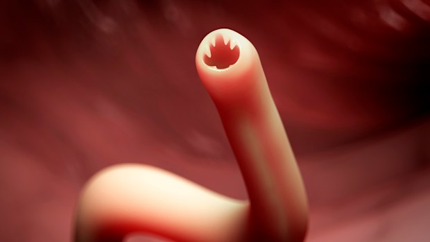 A computer generated image of a parasitic hookworm. (AFP)