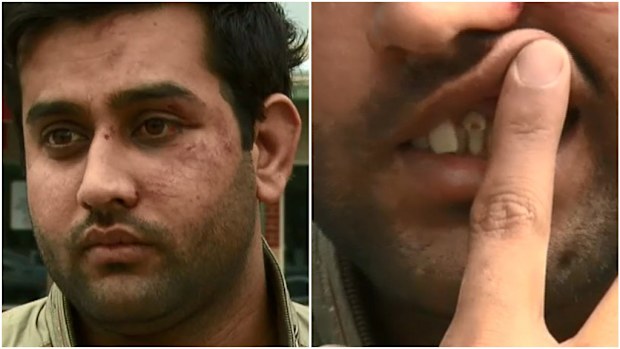 Cab driver Akbar Ali suffered two broken teeth after four teens allegedly refused to pay a $45 fare. 