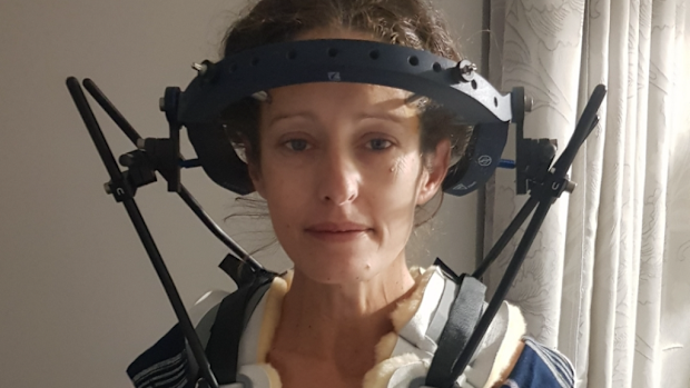 Woman hypermobility neck brace awaiting life-saving surgery