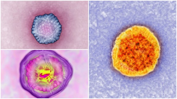 Antivirals for various strains of hepatitis (A,B and C pictured) may interact with potentially deadly consequences. (Getty)