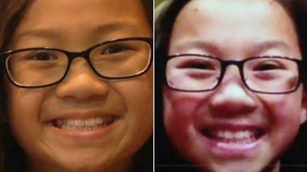 Twins Audrey and Gracie hope to reunite in the near future. (KNDO)