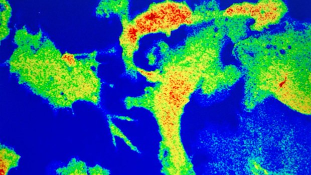 Highly magnified images of human blood cells are studied at The Ragon Institute in Cambridge (Getty)