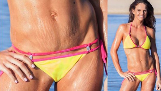 Bikini body pride - stretch marks be damned. Image: Instagram/@sharniandjulius