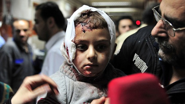 A wounded child at a hospital in Damascus after the blasts. (AAP)