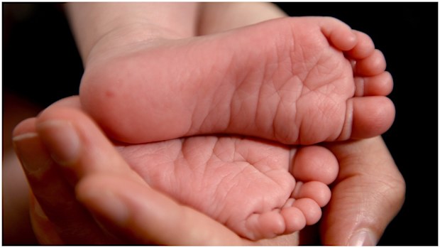 The cost of a caesarean section is estimated at $14,086 in Australia, $6708 cheaper than in the US. (AAP)