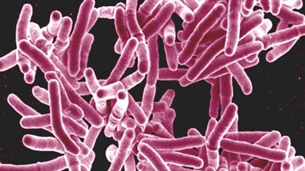 The microbacterium tuberculosis bacteria, the cause of TB. (NIAID)