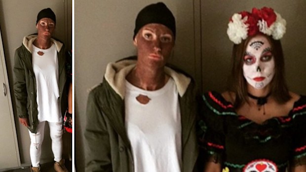 Opals player Alice Kunek dressed in blackface. (Instagram)