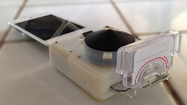 A full laboratory-quality immunoassay can be run on a smartphone accessory. (Columbia Engineering)