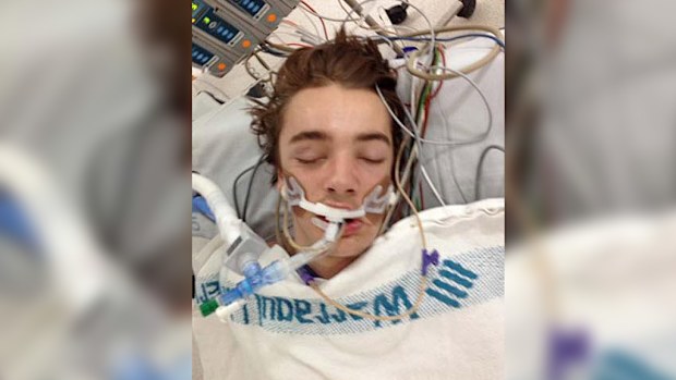 Brock Toulson, 16, who has suffered from a one-punch attack. (Supplied)