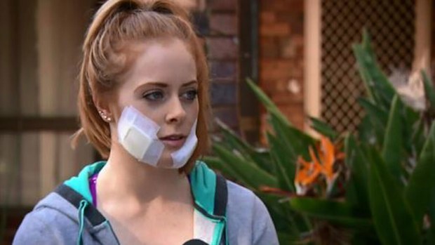 Zookeeper Emma Mitchell-Collett, 23, spent three days in hospital and is facing surgery. (9NEWS)