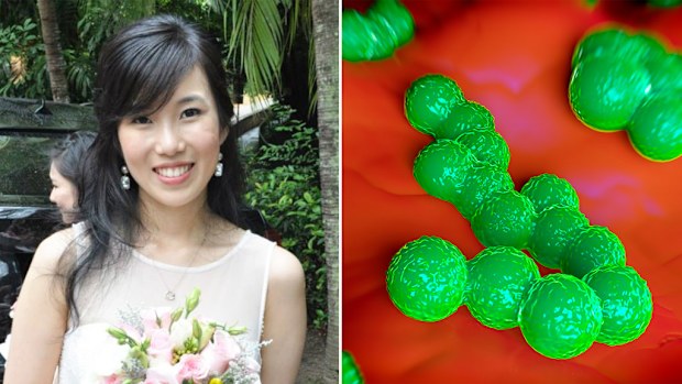 Malaysian woman Shu Lam, 25; methicillin-resistant Staphylococcus aureus bacteria. (Twitter/shujlam/AFP)