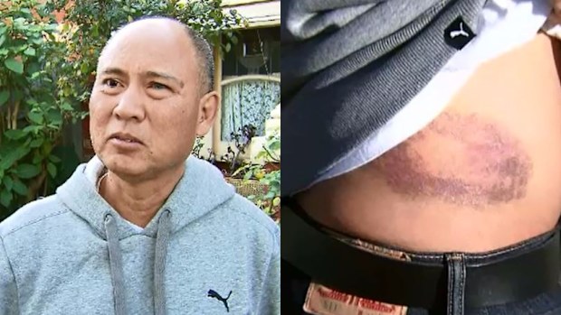 Nam Luc (left) fell onto the tracks, causing bruising to his right side. (9NEWS)