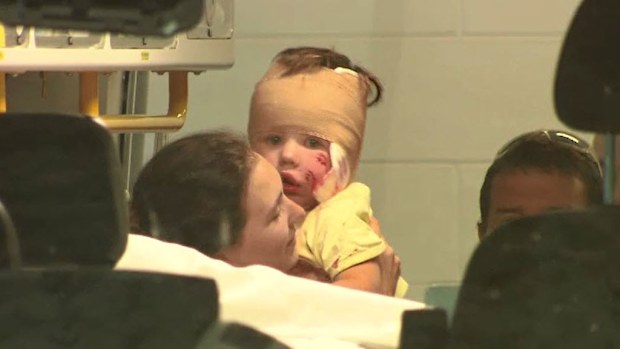 The toddler was attacked by a Staffordshire terrier. (9NEWS)