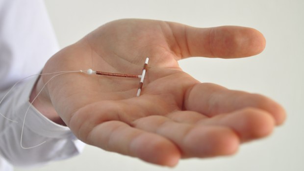 IUD in woman's abdomen