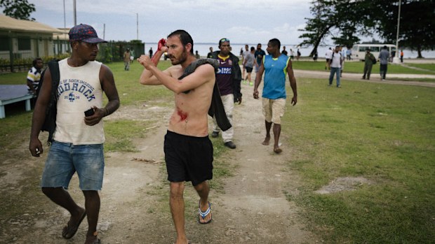 Two Afghan Hazaras were allegedly attacked by a group of locals. (Matthew Abbott/Get Up via AAP)