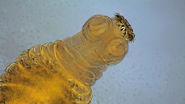 A South Australian toddler has been diagnosed with a rare form of tapeworm. (AFP)