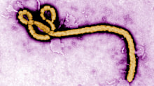 The disease, caused by several viruses, has a high mortality rate. 