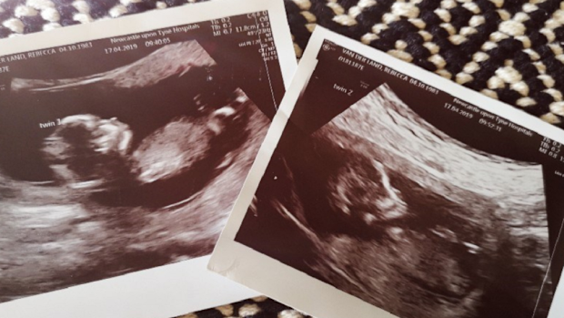 ultra sound twins