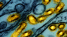 The H5 strain of bird flu reached Heard Island, an extremely remote Australian territory, late last year, and is now suspected to have been detected on the mainland.