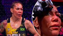 Cris Cyborg deals with her cuts.