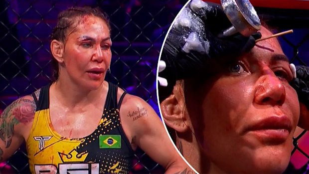 Cris Cyborg behandelt de wond.