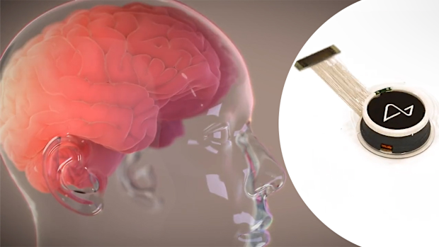 Neuralink