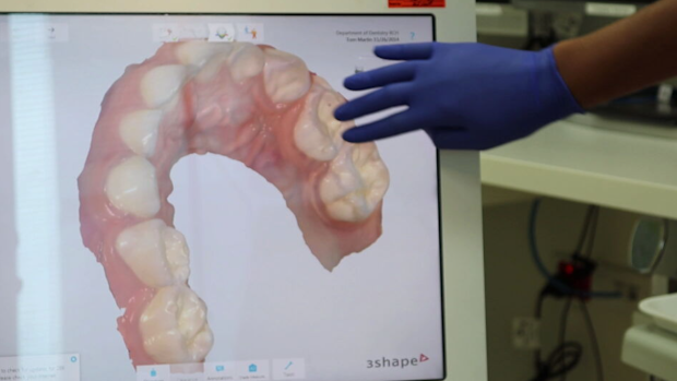 Children living in rural areas could benefit with the scans being viewed remotely, allowing dentists to easily get a second or specialist opinion. 