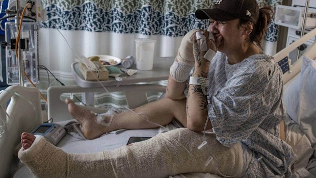 Bridget Quartermain was seriously injured when she was attacked by a dog at her friend's house.