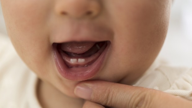 Baby with two teeth